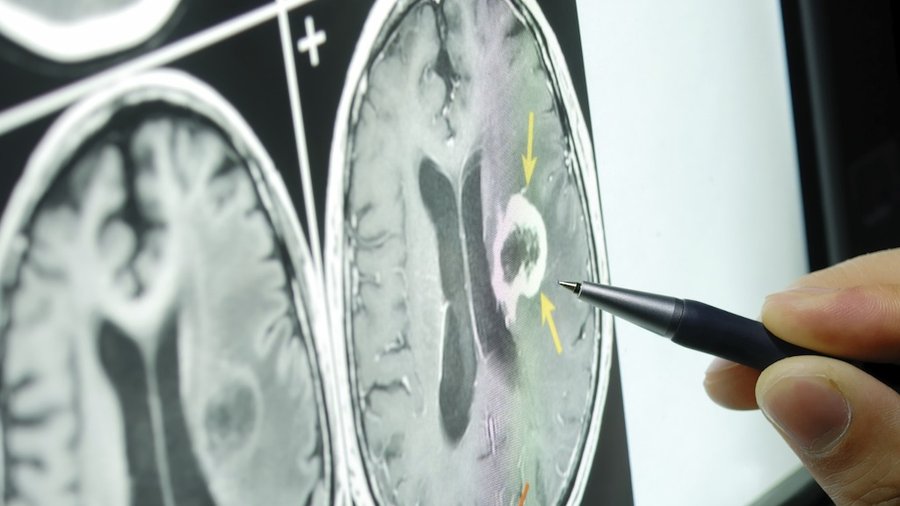 stkanalyzingbrainscan_900xx1024-576-0-55.jpg